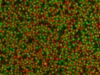 Band formation of oppositely charged colloids